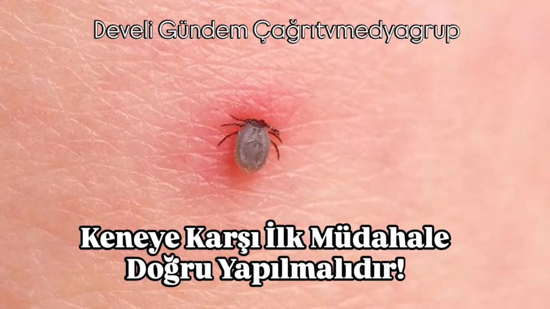 Kene Uyarısı! 